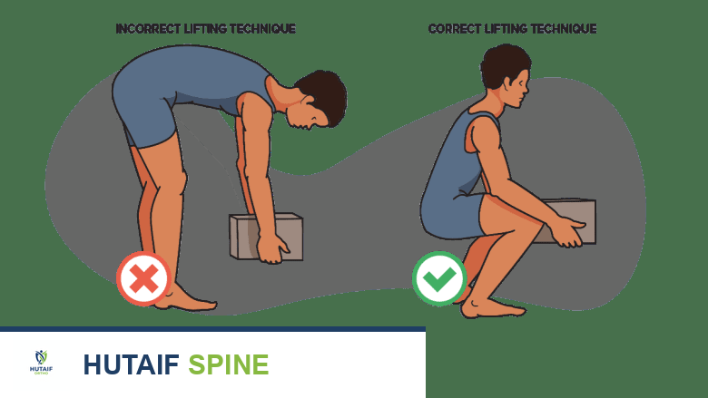 صورة توضيحية لـ علاج فقرات L4-L5: دليل شامل لآلام أسفل الظهر وعرق النسا