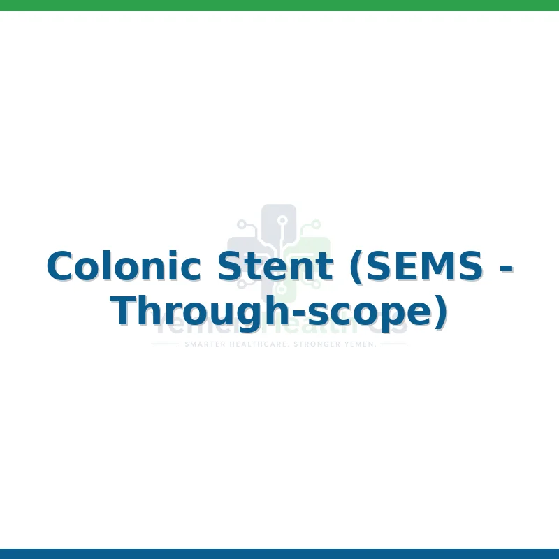 Colonic Stent (SEMS - Through-scope)
