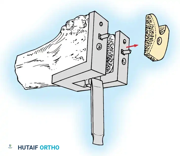 الأدوات الجراحية المستخدمة في القياس