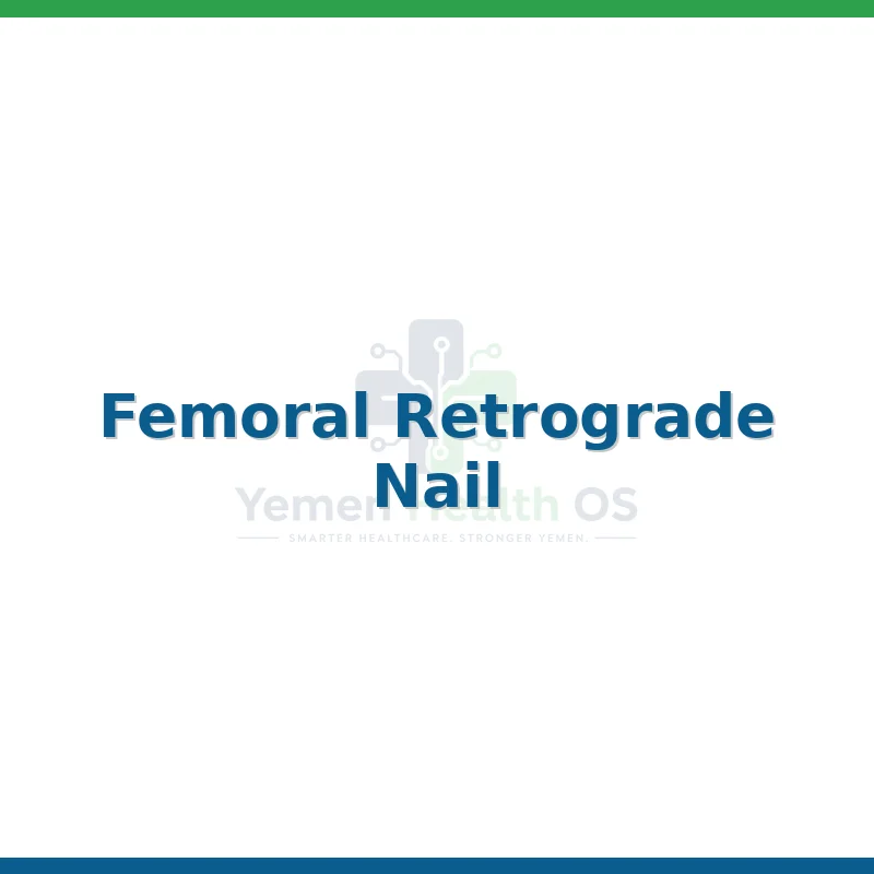 Femoral Retrograde Nail